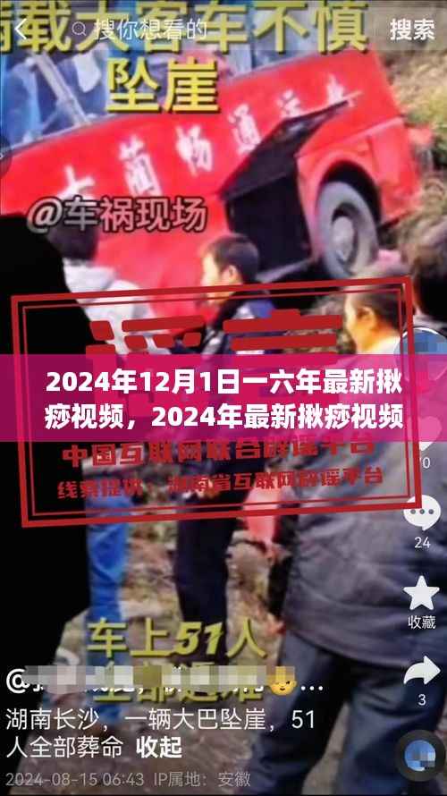 探究刮痧技艺演变与实践,最新揪痧视频风潮席卷至2024年12月1日