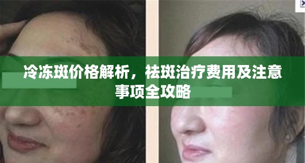 冷冻斑价格解析,祛斑治疗费用及注意事项全攻略