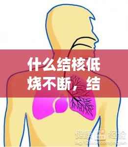 什么结核低烧不断,结核低热能自愈吗